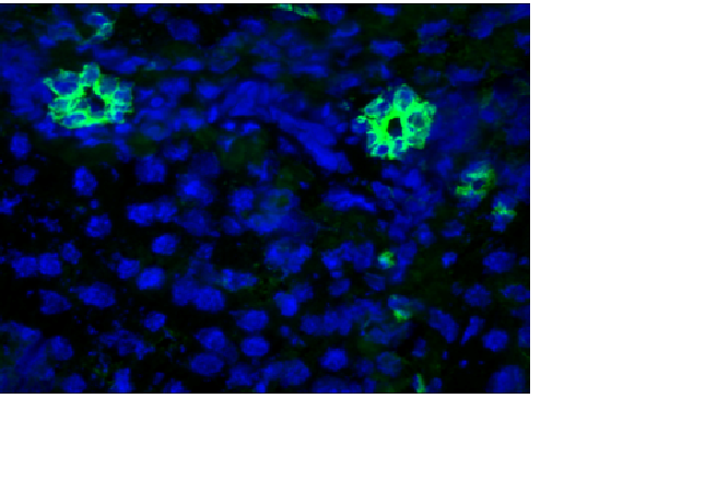 Figure 4. - Immunohistochemistry of MUB0315P (RCK105) on frozen sections of human liver showing positive staining in the epithelial cells lining the bile ducts and no reactivity in hepatocytes or connective tissue. Dilution 1:500